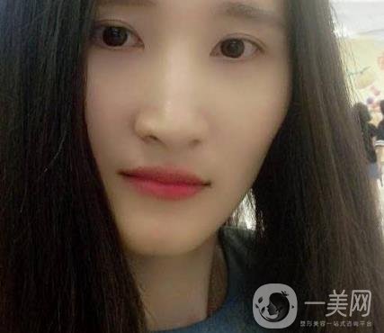北京市海淀醫(yī)院整牙多少錢？看價格表及案例*果