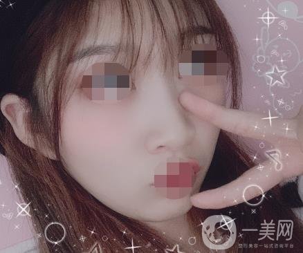 河北省中醫(yī)院整形美容科去疤*果如何？?jī)r(jià)格表及案例實(shí)拍圖公布