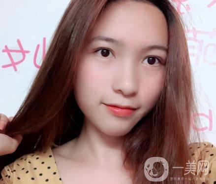 沈陽軍區(qū)總醫(yī)院整形外科價格表2020，附雙眼皮案例