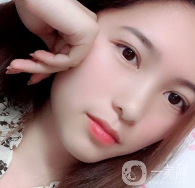 沈陽軍區(qū)總醫(yī)院整形外科價格表2020，附雙眼皮案例