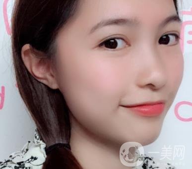 沈陽軍區(qū)總醫(yī)院整形外科價格表2020，附雙眼皮案例
