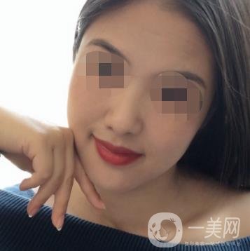 鹽城東方女子整形醫(yī)院價格表_點痣*果一覽