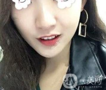 浙二醫(yī)院整形美容科價格表*新版，附激光祛斑*終*果圖