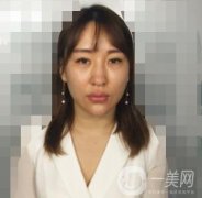 廣州高尚醫(yī)學(xué)美容中心隆鼻價格表和案例