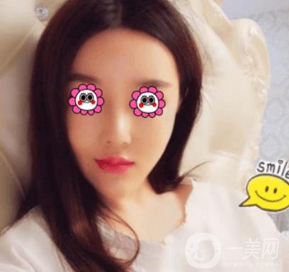 長沙中南大學(xué)*三醫(yī)院整形美容外科隆鼻多少錢？價格表及案例詳情