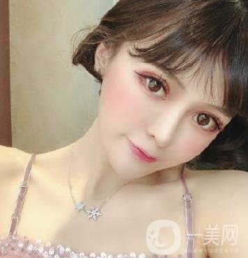 石家莊市醫(yī)院整形美容外科價格表2020，附雙眼皮實例