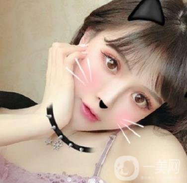 石家莊市醫(yī)院整形美容外科價格表2020，附雙眼皮實例