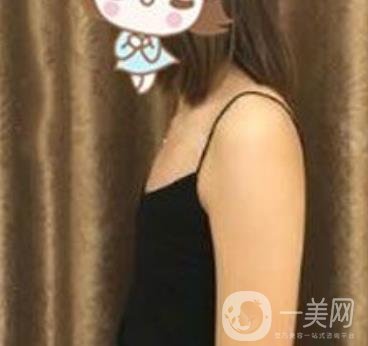 上海李斌醫(yī)療美容隆胸怎么樣?項目整形價格表收費標(biāo)準(zhǔn)公布