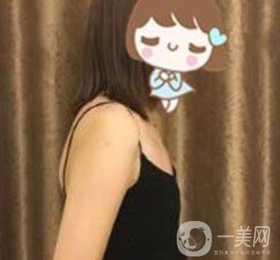上海李斌醫(yī)療美容隆胸怎么樣?項目整形價格表收費標(biāo)準(zhǔn)公布