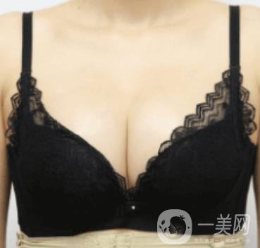 上海美貝爾明橋醫(yī)院價(jià)格(目)一覽表，附孫超醫(yī)生隆胸經(jīng)驗(yàn)分享