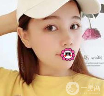 河南省人民醫(yī)院誰(shuí)做雙眼皮好？附案例及2020整形價(jià)格表