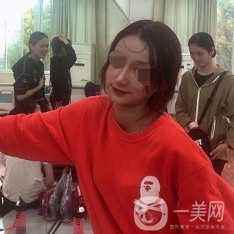 遼寧省人民醫(yī)院美容科怎么樣？附袁繼龍隆鼻案例