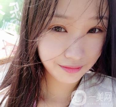 北大醫(yī)院美容價(jià)格表，附自體脂肪填充面部前后照