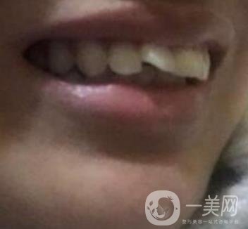 北京醫(yī)院整牙
