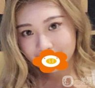 常州一院美容科價格表，*前后果圖一覽