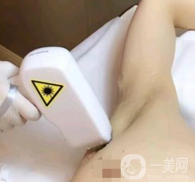 廈門中醫(yī)院陳華脫毛靠譜嗎？價(jià)格表及案例*果一覽