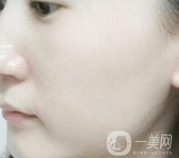南通大學(xué)附屬醫(yī)院整形科價(jià)格表，附激光去疤案例