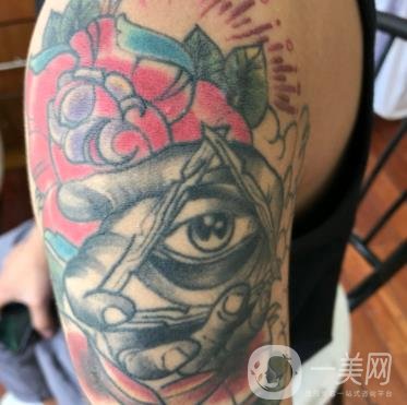 徐州市中心醫(yī)院整形科價(jià)格表，附洗紋身案例