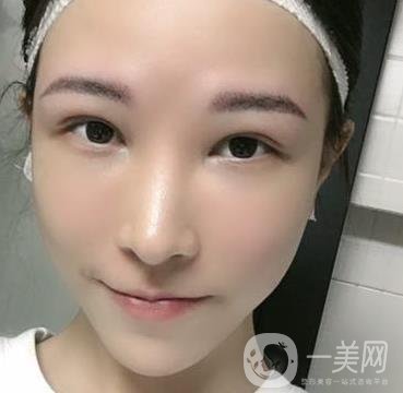 成都華美醫(yī)院做眉毛怎么樣?真實*果圖和價格一覽表展示