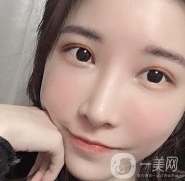 成都華美醫(yī)院做眉毛怎么樣?真實*果圖和價格一覽表展示