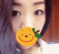 昆明市第一人民醫(yī)院雙眼皮多少錢？附案例及2020全新整形價格表