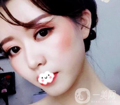 劉波醫(yī)生隆鼻修復(fù)