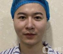 廈門邱健欽醫(yī)療美容價(jià)格表及隆鼻恢復(fù)果展示圖