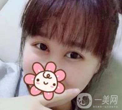上海華美楊亞益做眼睛多少錢？價(jià)格表及案例詳情