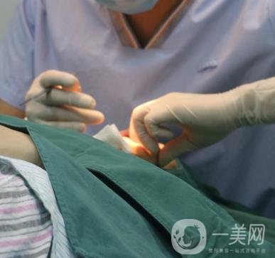 上海時光醫(yī)院何晉龍磨骨怎么樣？價格表及術(shù)后*果分享