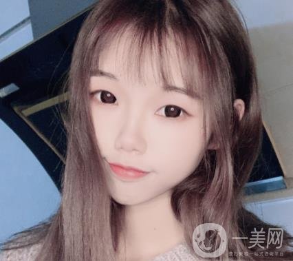 上海時光醫(yī)院何晉龍磨骨怎么樣？價格表及術(shù)后*果分享