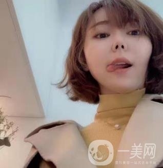 西南醫(yī)院美容整形科打*多少錢？?jī)r(jià)格表及案例*果
