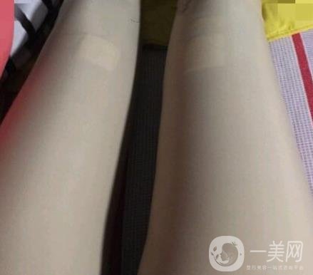 中南大學(xué)第一醫(yī)院整形美容科價格表*新發(fā)布,附全身吸脂*果分享