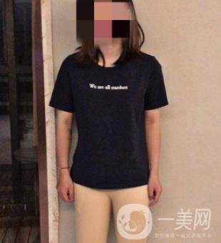中南大學(xué)第一醫(yī)院整形美容科價格表*新發(fā)布,附全身吸脂*果分享