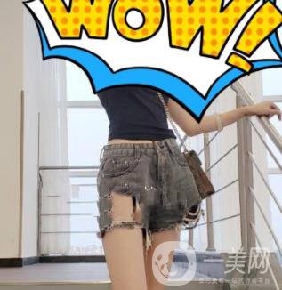 中南大學(xué)第一醫(yī)院整形美容科價格表*新發(fā)布,附全身吸脂*果分享