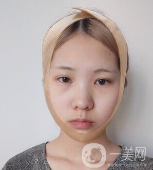 運(yùn)城中心醫(yī)院整形外科價(jià)格表，附顴骨降低案例分享