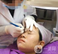 北京醫(yī)院整形科繡眉果怎么樣?2020年價格表日常收費詳情一覽