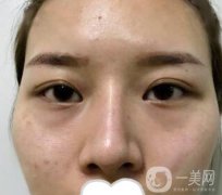江蘇省中醫(yī)院整形科價(jià)格表及自體脂肪填充案例一覽