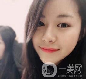 上海華美醫(yī)療美容醫(yī)院價格表，附雙眼皮修復(fù)案例