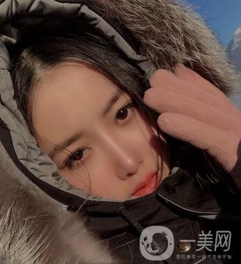 廣州曙光醫(yī)學(xué)美容醫(yī)院價格表及肋軟骨隆鼻案例分享