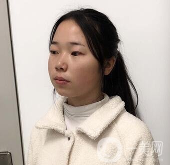 西安高一生醫(yī)療美容醫(yī)院價格表，附面部吸脂案例分享