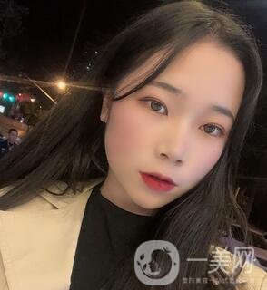 西安高一生醫(yī)療美容醫(yī)院價格表，附面部吸脂案例分享