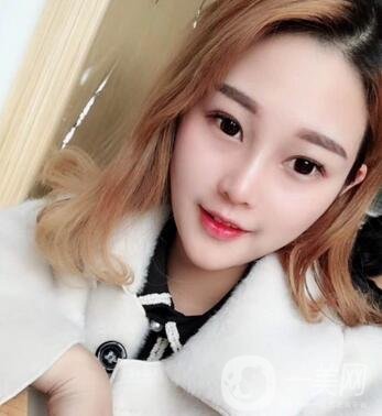 成都銅雀臺整形醫(yī)院隆鼻案例分享，附全新價格表