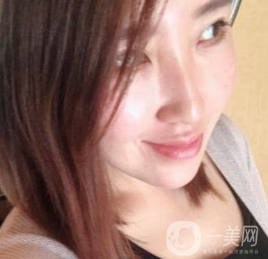 常州美貝爾整形美容醫(yī)院*注射多少錢？?jī)r(jià)格明細(xì)和*果圖展示