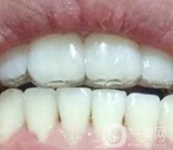 貴州口腔醫(yī)院正畸醫(yī)生信息介紹?內含牙齒美容項目價格表及案例