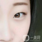 沈陽百嘉麗醫(yī)院價(jià)格表2020，附雙眼皮案例分享