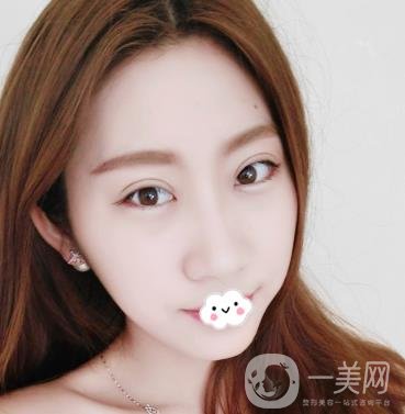 沈陽百嘉麗醫(yī)院價格表2020，附雙眼皮案例分享