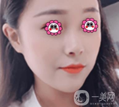 沈陽(yáng)伊美爾整形醫(yī)院價(jià)格表，附祛斑*果展示