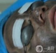 上海星和醫(yī)美整形醫(yī)院*祛斑果圖和價(jià)格價(jià)目表2020年
