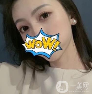 武漢艾萊美醫(yī)療整形醫(yī)院價格表項目收費明細(xì)，附雙眼皮案例
