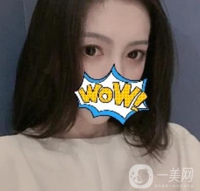 武漢艾萊美醫(yī)療整形醫(yī)院價格表項目收費明細(xì)，附雙眼皮案例